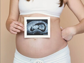 Femme enceinte détendue, représentant les bienfaits élargis des probiotiques pour soutenir la fertilité masculine et féminine au-delà de la santé digestive